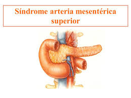 sindrome AMS