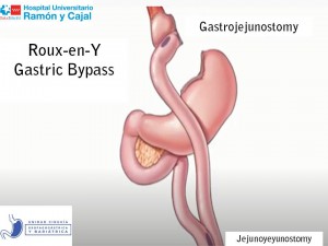 Diapositiva2