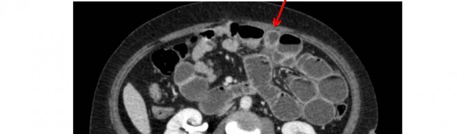 Diapositiva3