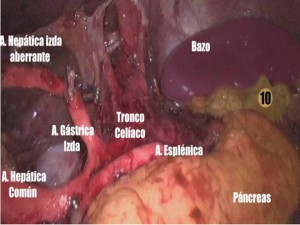 Fotograma LN D2