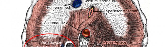 Hernia Bochdaleck derecha